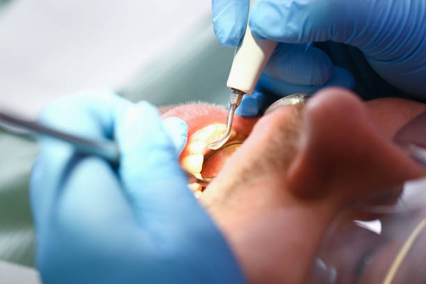 Best Cosmetic Emergency Dentistry in Corcoran, MN