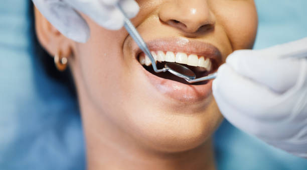Best Emergency Denture Repair in Corcoran, MN