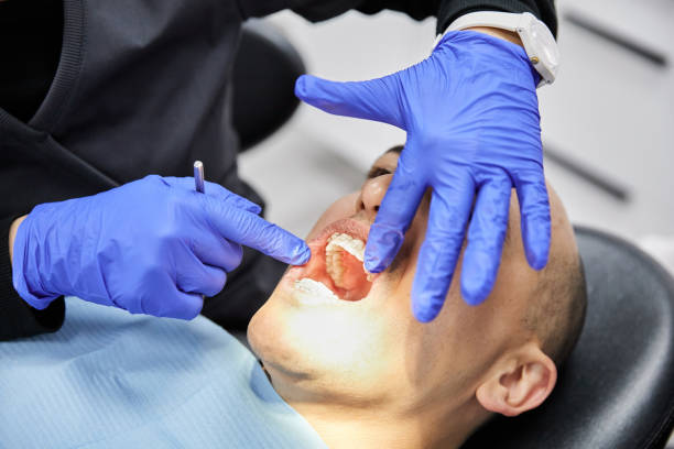 Best After-Hours Dental Trauma Care in Corcoran, MN